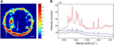 Label-Free Protein Analysis by Pyro-Electrohydrodynamic Jet Printing of Gold Nanoparticles